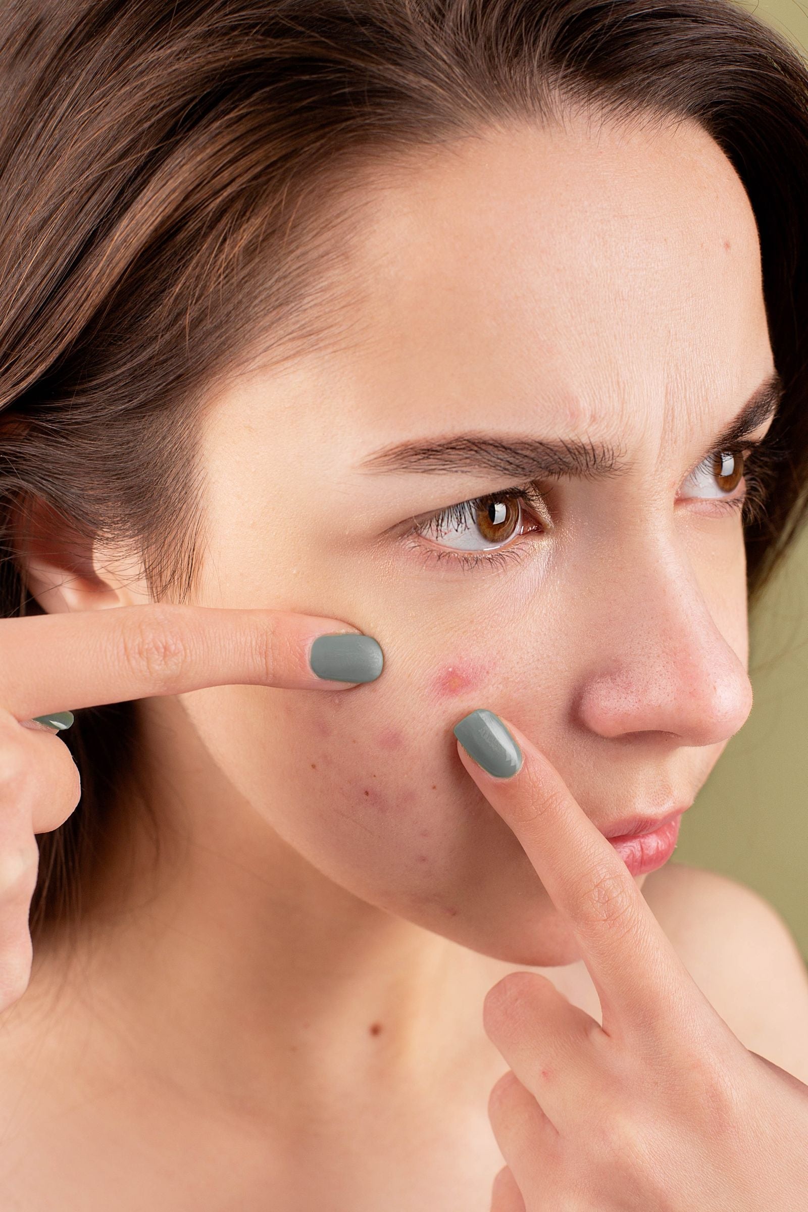 Woman checking irritated, red skin on her cheek